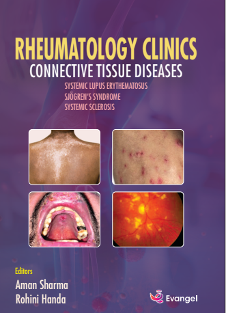 Rheumatology clinics Connective Tissue Diseases 1st/2025